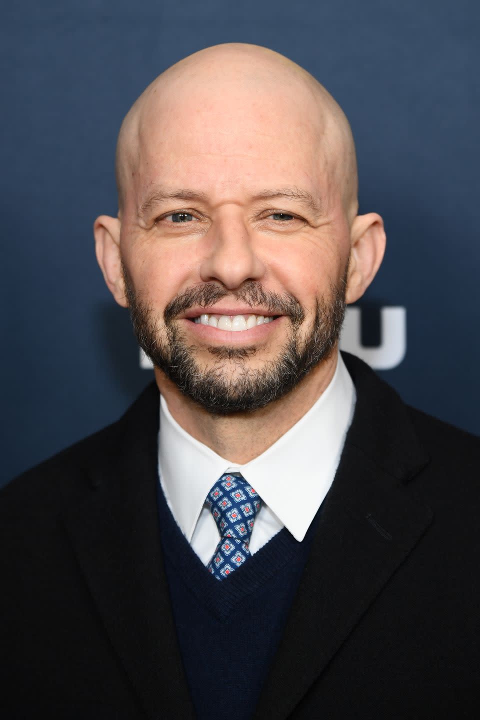 Jon Cryer (head that's bare)