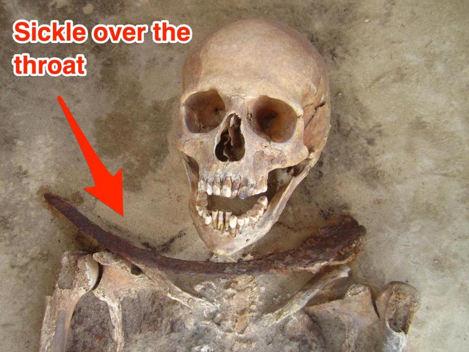 The image of a skeletonized body buried with a sickle around the throat is shown with an arrow pointing at the sickle.