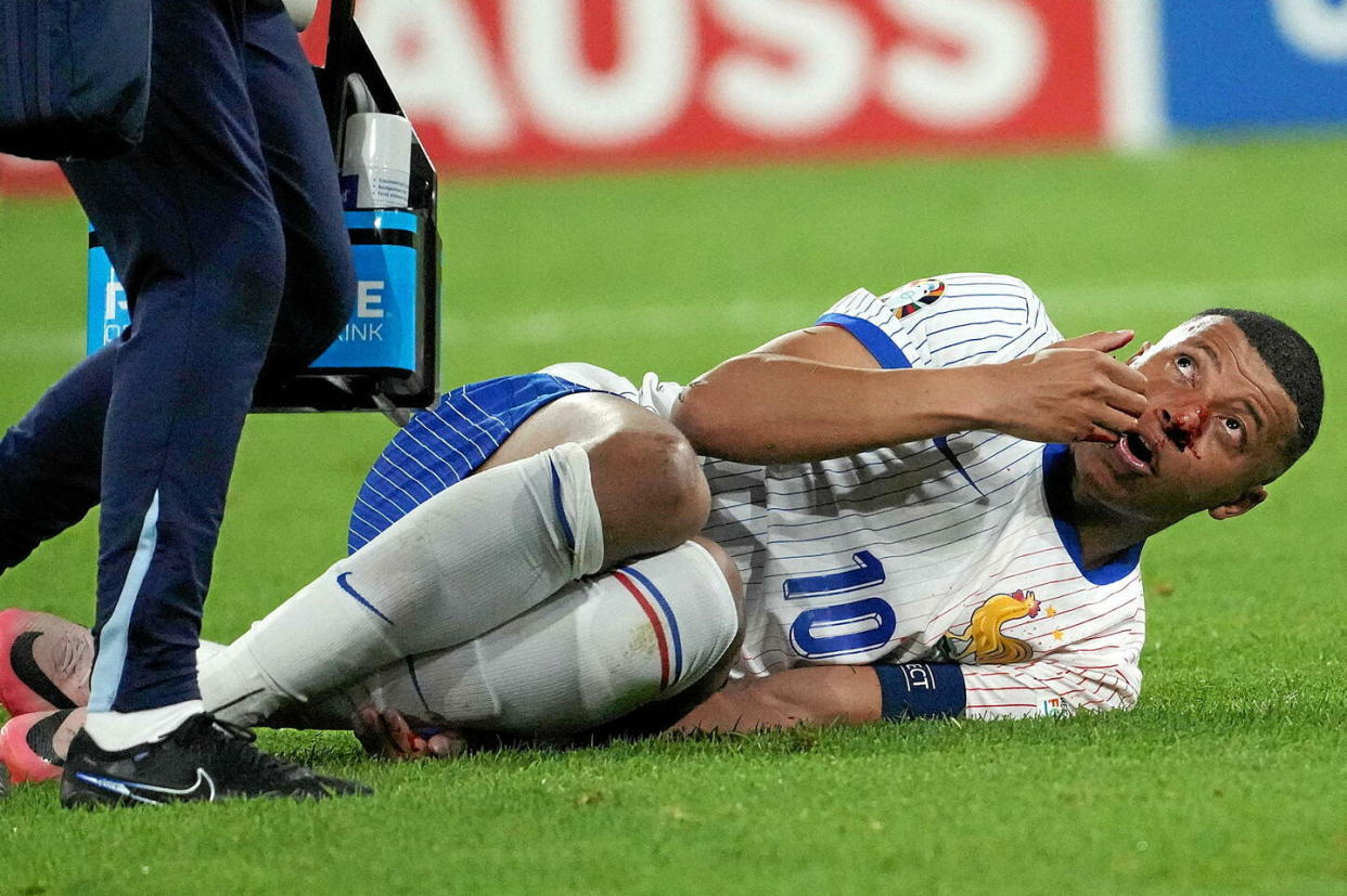 Kylian Mbappé, blessé au nez, n'a pas été en mesure de terminer le premier match de la France lors de l'Euro 2024, face à l'Autriche.  - Credit:Hasan Bratic - Sipa