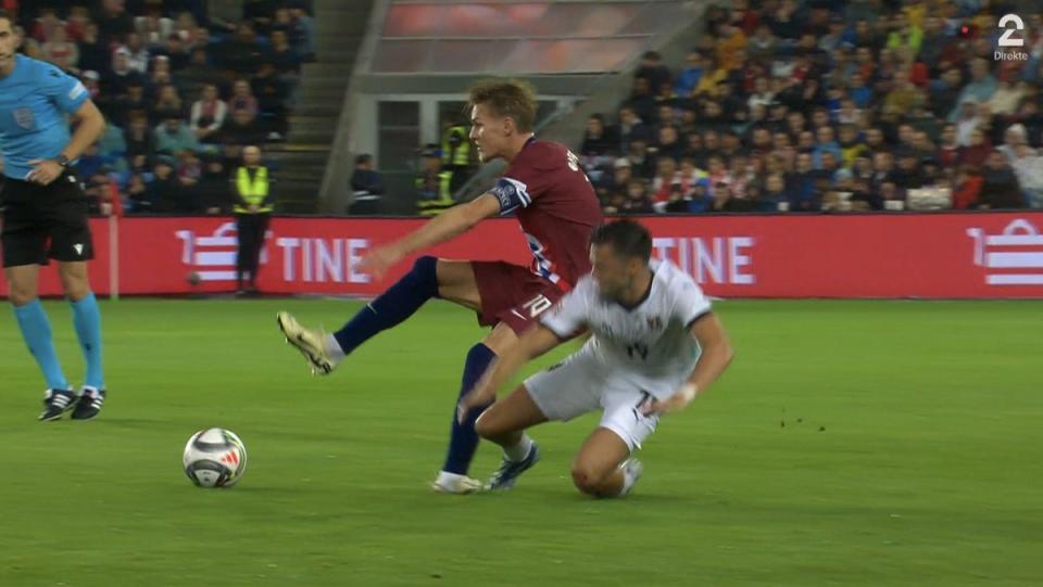 Odegaard was injured on international duty for Norway (TV2)