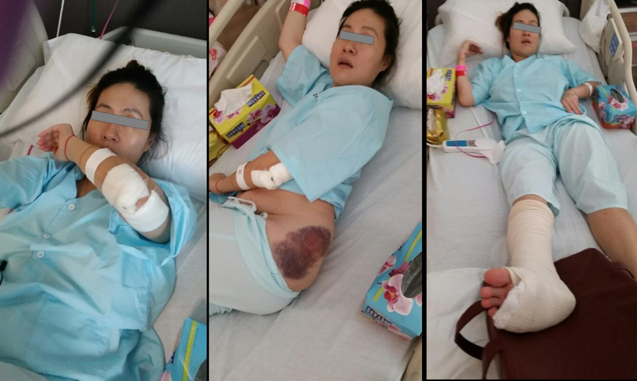 Chan Hui Peng fell into a manhole in in Kovan in 2015. (PHOTO: Legal Standard LLP)