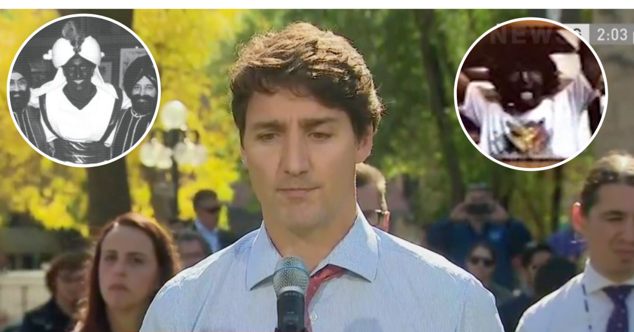 A composite image shows Justin Trudeau in two images where he donned blackface and brownface, and an image of him speaking during a press conference during which time he apologized for his actions.