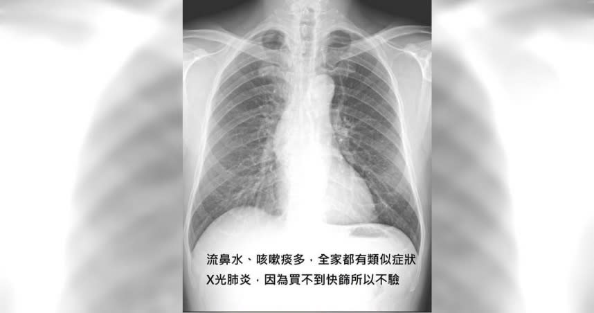 醫師表示，有患者照了X光發現肺炎卻未驗快篩，原因竟是買不到。（圖／翻攝自蘇一峰臉書）
