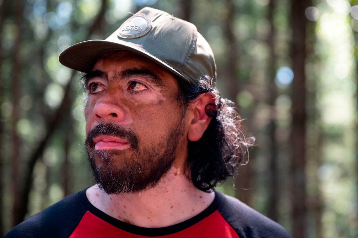 J.R. Marquez, 48, pauses for a moment while talking about the situations that brought him to be living in a homeless encampment in the 9700 block of Steele Street South on far south end of Tacoma on Thursday, May 25, 2023.