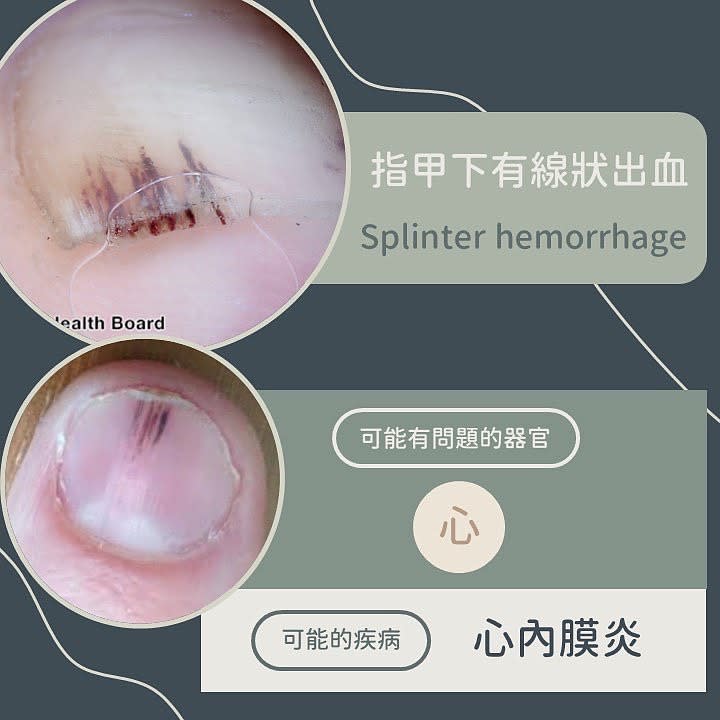 黃晨昊醫師 授權提供