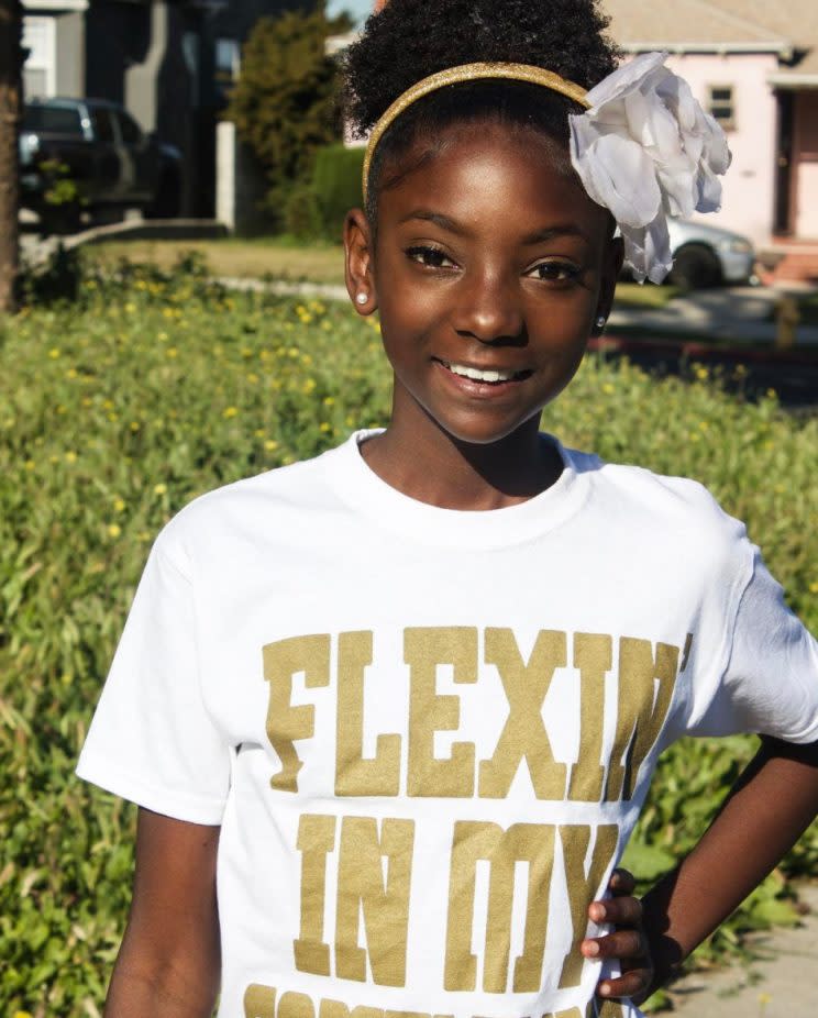 10-year-old bullied for her skin is launching a fashion line