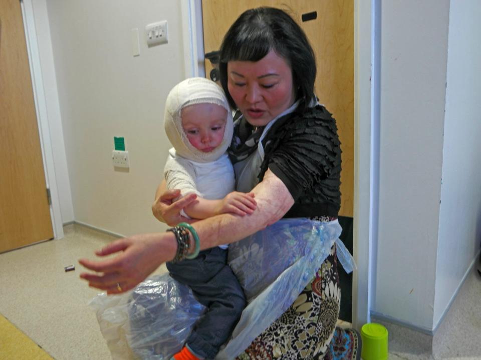 Kim Phuc at the pediatrics burn victim unit at hospital in Westchester, England, January 2015.