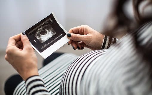 Recurring miscarriages may be caused by an underlying infection, scientists believe, as they launched a major trial to find if the problem can be cured with a simple course of antibiotics. - miodrag ignjatovic