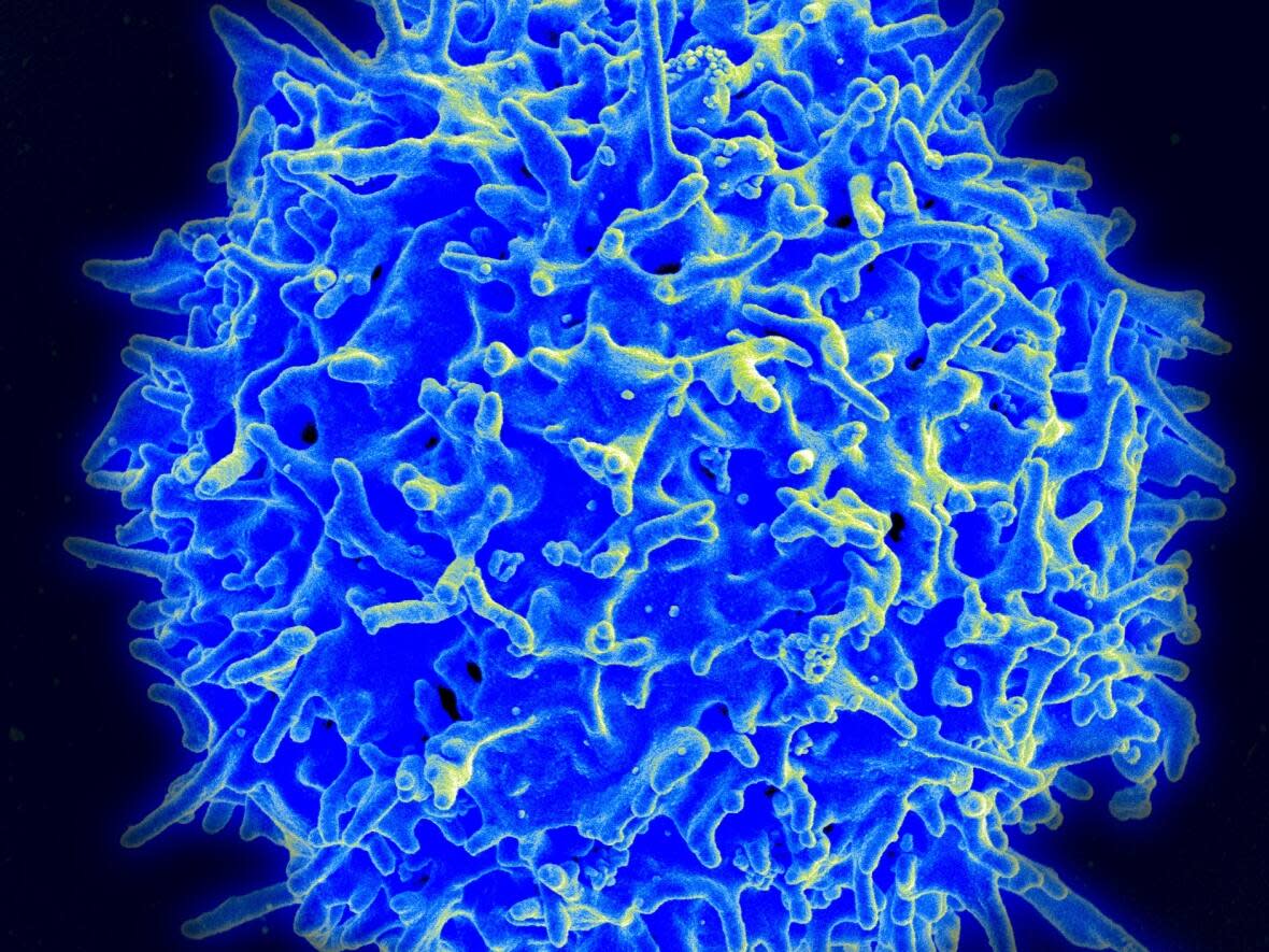 The human T-cell, pictured here in a scanning electron micrograph, is key to CAR T immunotherapy. The treatment is now available to cancer patients in Saskatchewan. (U.S. National Institute of Allergy and Infectious Diseases - image credit)