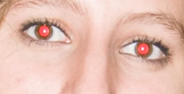 Close-up of a person's eyes with red-eye effect from camera flash