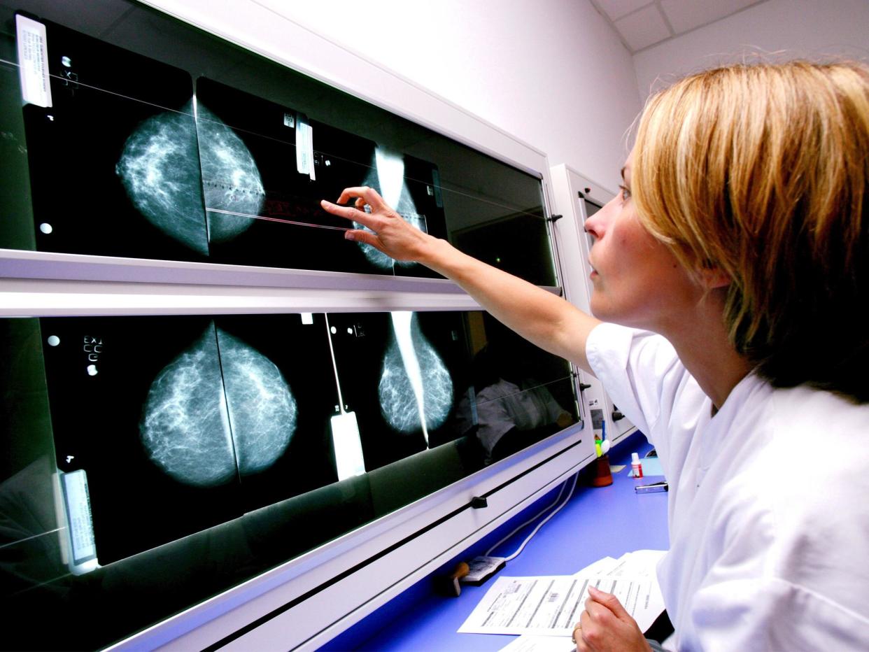 A radiologist examines mammograms on a lightbox: Rex/Shutterstock