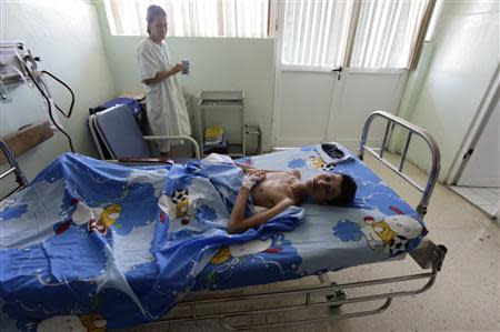 Javier Aleman Cervantes, 21, lies in bed at the William Soler Children's Heart Center after surgery in Havana October 7, 2013. REUTERS/Desmond Boylan