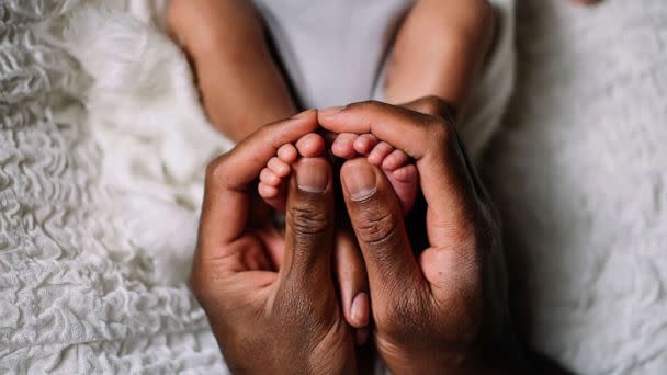 PHOTO: A babies feet are seen in this undated stock photo. (STOCK PHOTO/Getty Images)