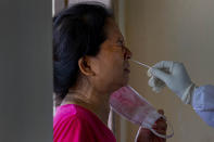 A woman grimaces as her nasal swab is being collected in Gauhati, India, Saturday, July 4, 2020. India's number of coronavirus cases passed 600,000 with the nation's infection curve rising and its testing capacity being increased. More than 60% of the cases are in the worst-hit Maharashtra state, Tamil Nadu state, and the capital territory of New Delhi. (AP Photo/Anupam Nath)