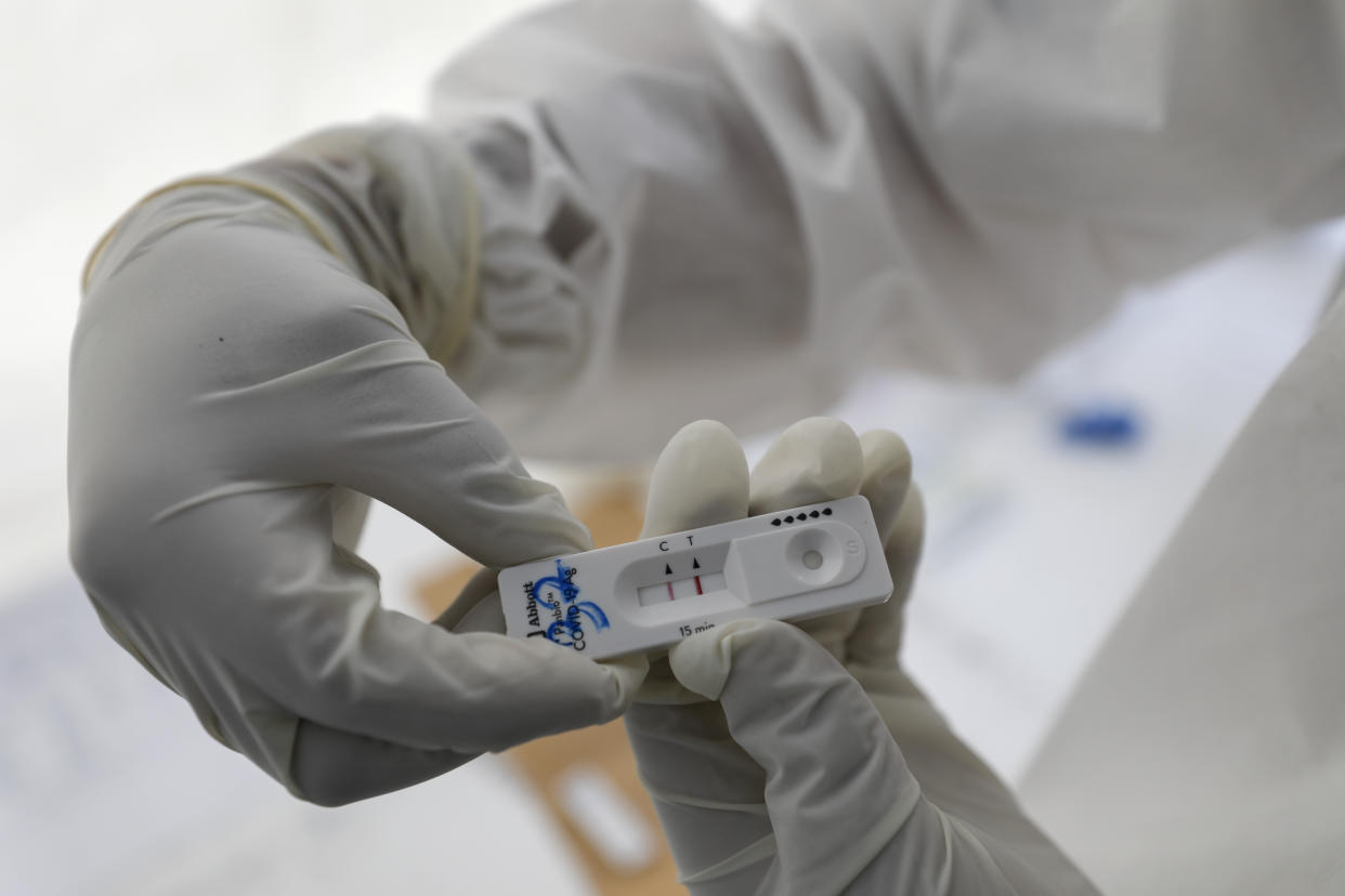 A medical worker holds a rapid COVID-19 test showing a positive result, at a testing site set up by the city department of health outside the Pino Suarez subway station, in central Mexico City, Friday, Dec. 4, 2020. While the city has significantly increased free testing, demand continues to outstrip availability, and some residents lined up as early as 5:30 a.m. Friday to make sure they got a test. (AP Photo/Rebecca Blackwell)