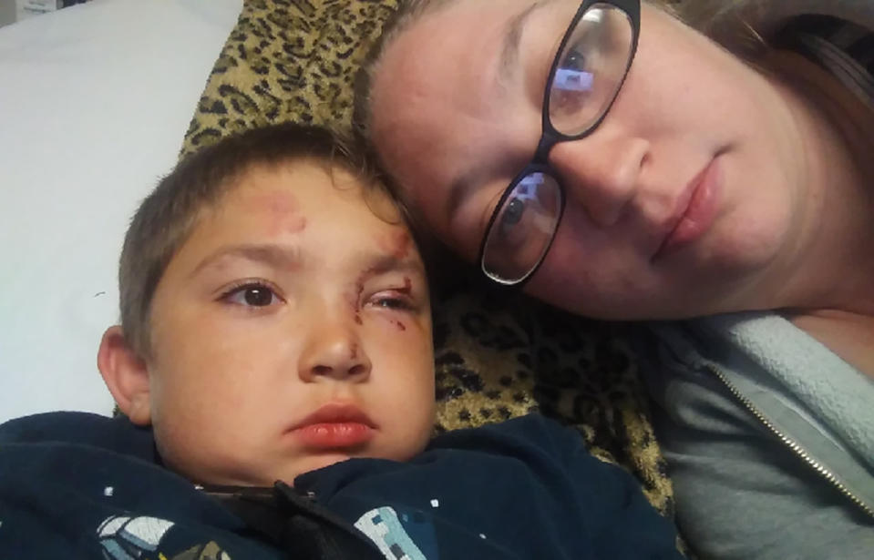 Olympia Washington US 6 year old boy Carter English attacked stopping bullies.