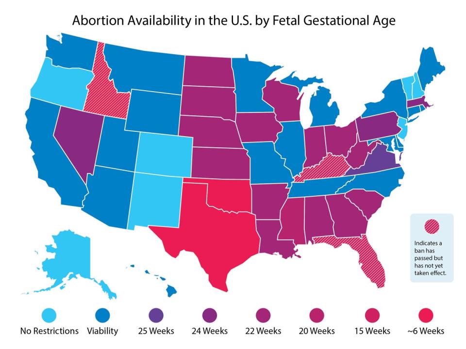 Abortion laws in the US Map