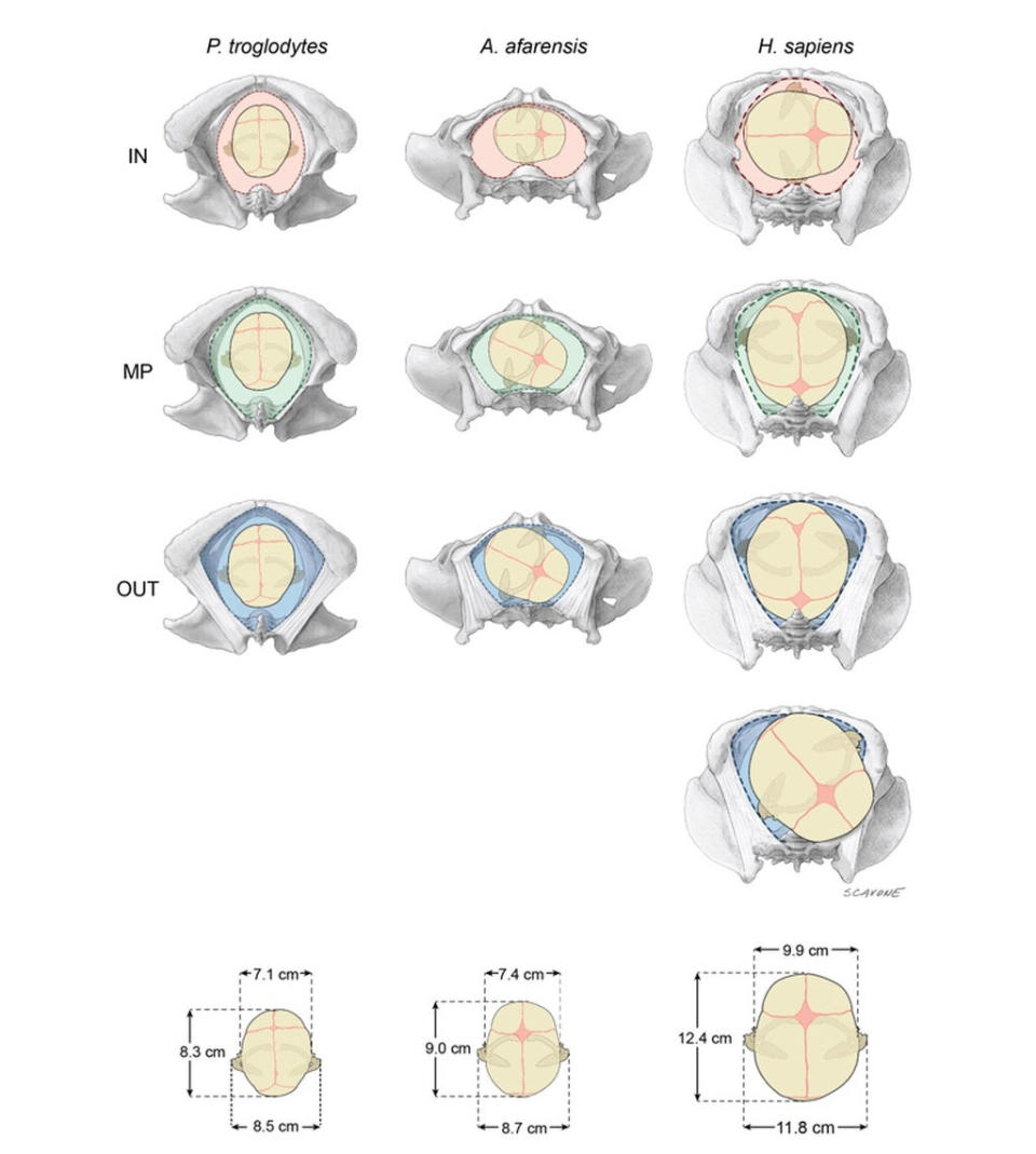 An illustration of how primates give birth. Left: Chimpanzee newborns (top to bottom) do not rotate as they exit the birth canal. Right: Human newborns (top to bottom) rotate as they exit the birth canal. Middle: Researchers think Australopithecus afarensis newborns (top to bottom) rotated a bit as they exited the birth canal, but not as much as human infants do. <cite>William Scavone</cite>
