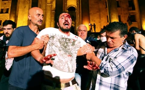 Protesters help a man wounded in clashes with police - Credit: Zurab Tsertsvadze/AP&nbsp;