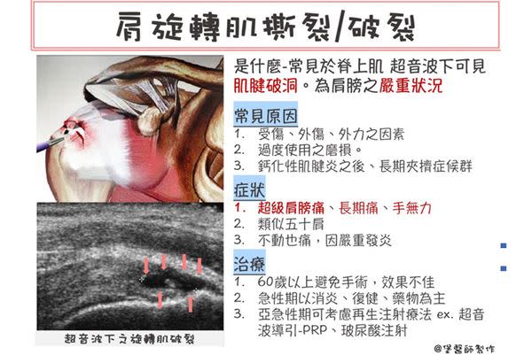 （圖片提供／侯鐘堡醫師By復健醫學會）