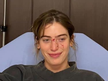 Clara McGregor smiles away despite suffering injuries from a dog bite (Instagram)