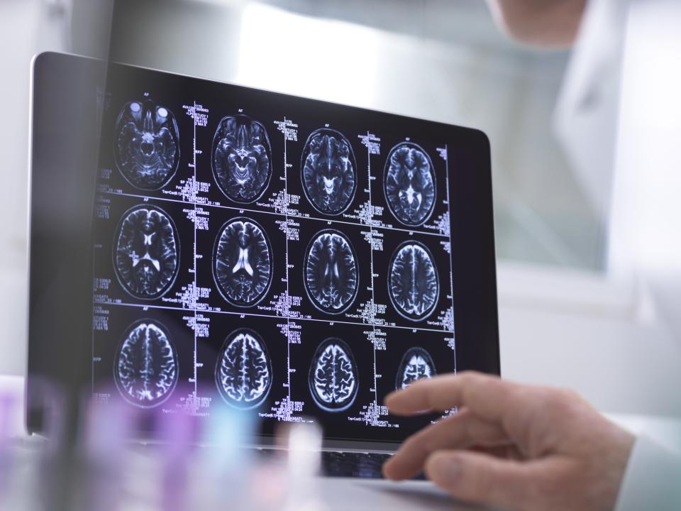 Human brain scan being analysed in a neurology clinic.