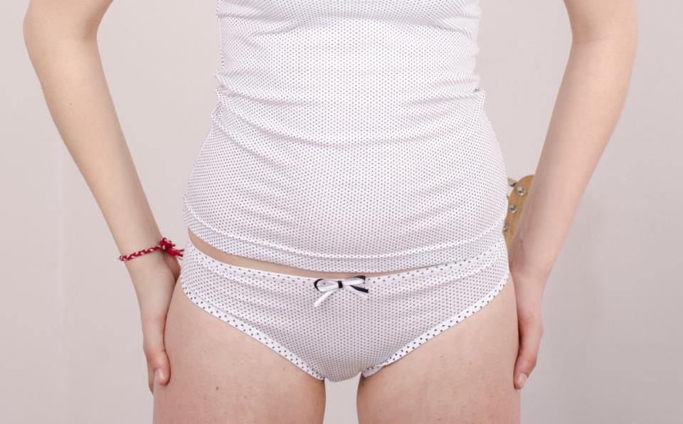 PSA: You *might* be allergic to your underwear, and the results are not pretty