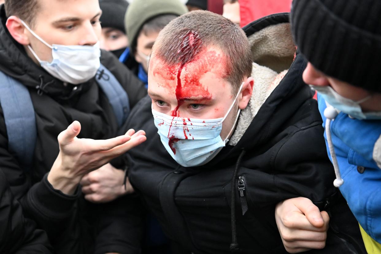 <p>An injured man is helped by other protesters during a rally in support of jailed opposition leader Alexei Navalny in downtown Moscow </p> (AFP via Getty)