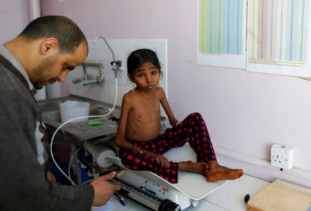 A nurse weighs Afaf Hussein, 10, who is malnourished, at the malnutrition treatment ward of al-Sabeen hospital in Sanaa, Yemen, January 31, 2019. Afaf, who now weighs around 11 kg and is described by her doctor as "skin and bones", has been left acutely malnourished by a limited diet during her growing years and suffering from hepatitis, likely caused by infected water. She left school two years ago because she got too weak. REUTERS/Khaled Abdullah