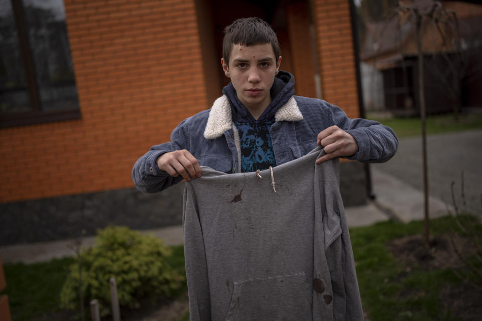 Yura Nechyporenko, 15, holds the hoodie he was wearing the day a Russian soldier tried to execute him in Bucha, on the outskirts of Kyiv, Ukraine, on Tuesday, April 19, 2022. His father was killed, and now his family seeks justice. The hoodie, bloodied at the elbow where a bullet had pierced him, is now the centerpiece of the family's search for justice. Yura's mother, Alla, insisted that it not be thrown away. (AP Photo/Emilio Morenatti)