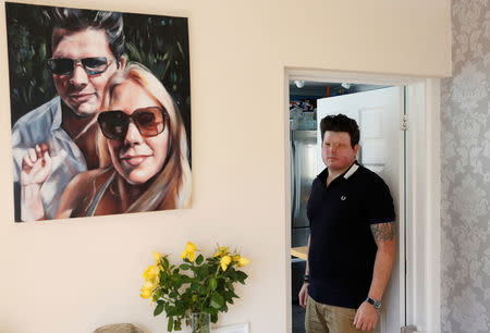 Acid attack victim Andreas Christopheros, poses for a photograph in his home in Truro, south-west England, Britain July 31, 2017. REUTERS/Peter Nicholls