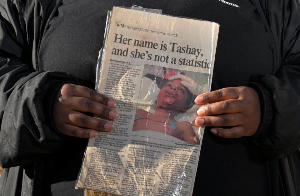 When mocked at school for her scars, Tashay Campbell, now 36, would bring classmates this copy of her story published in The Star to explain where they came from.