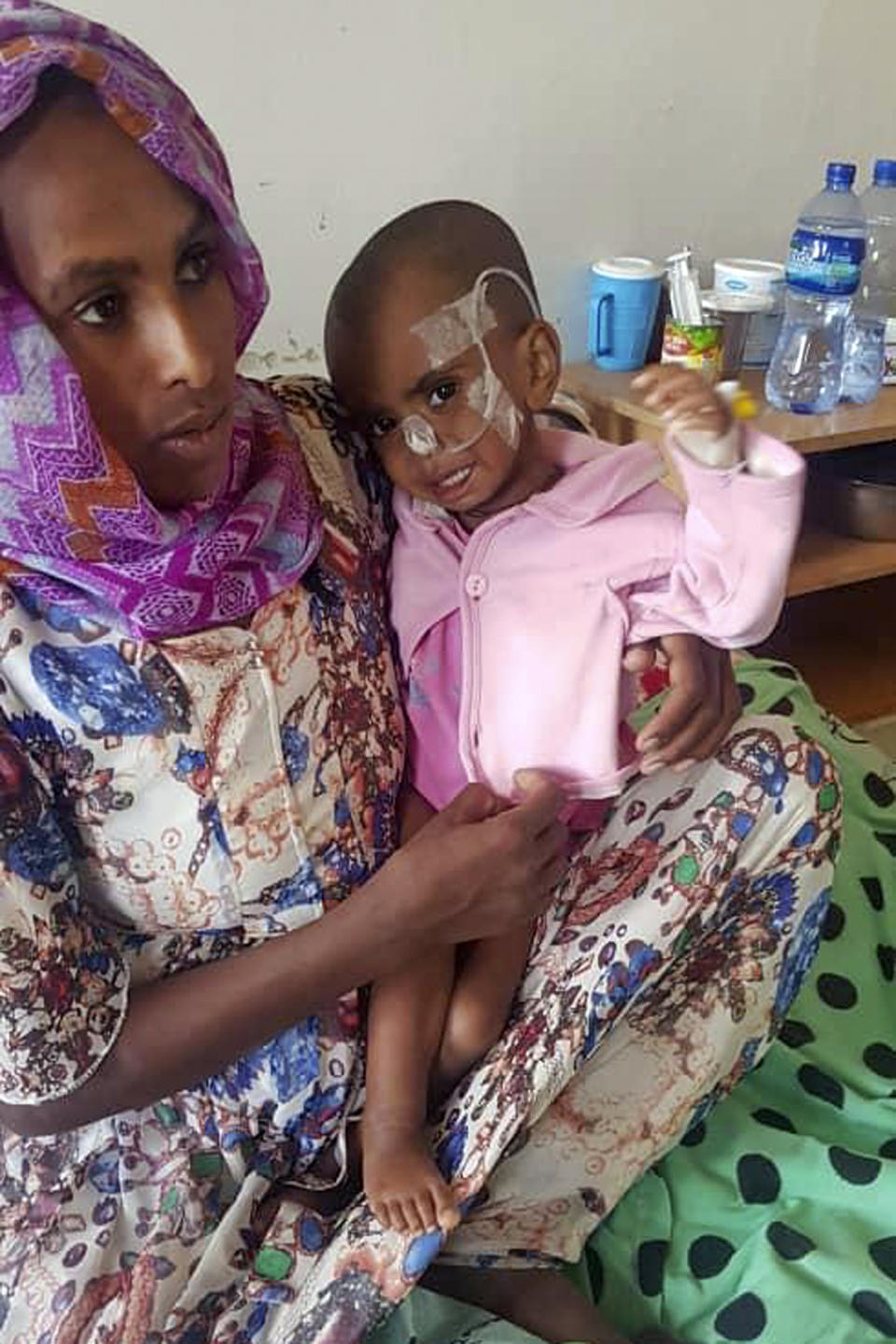 Selam Mulu, 2, is treated for malnutrition at the Ayder Referral Hospital in Mekele, in the Tigray region of northern Ethiopia, Tuesday, Oct. 4, 2022. Babies are dying in their first month of life at four times the rate they did before the war in Ethiopia's Tigray region, according to a yet-unpublished study shared by its authors with The Associated Press. (AP Photo)