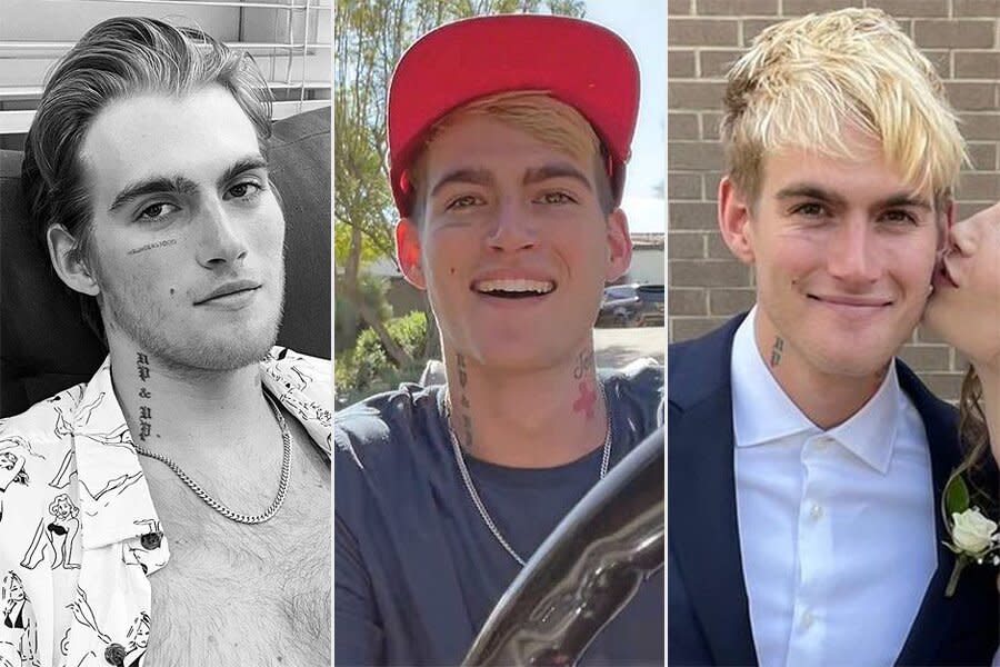 Presley Gerber face tattoo removal