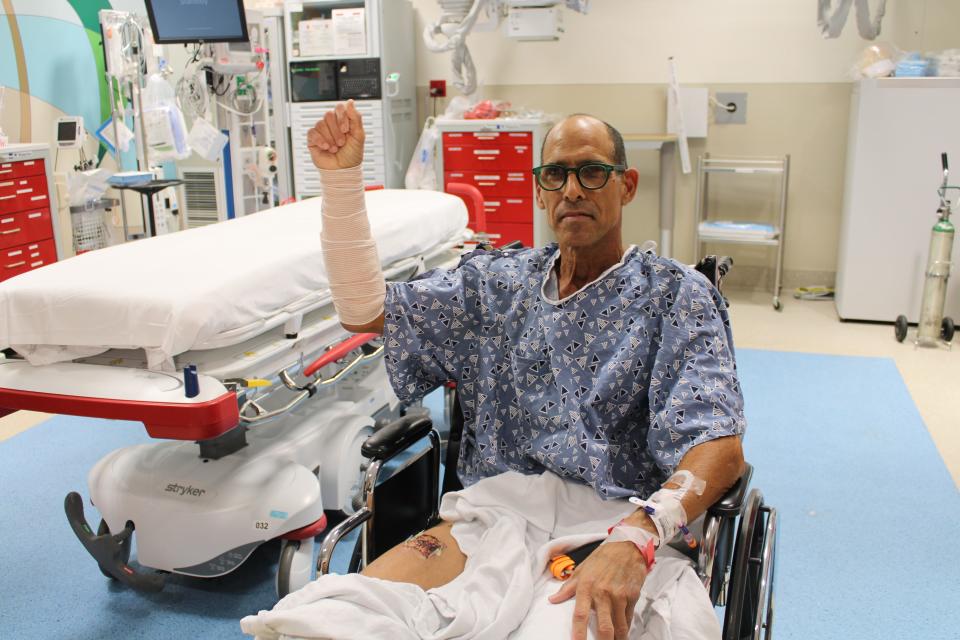 Steven Reinhardt, 60, of Palm Beach Gardens holds up his injured right arm at St. Mary's Medical Center on Nov. 15, 2023. The arm was attacked by a shark in Juno Beach on Nov. 5, 2023.