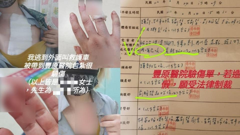 人妻指控遭婆婆傷害，到醫院治療驗傷。（圖／翻攝自爆料公社二社）