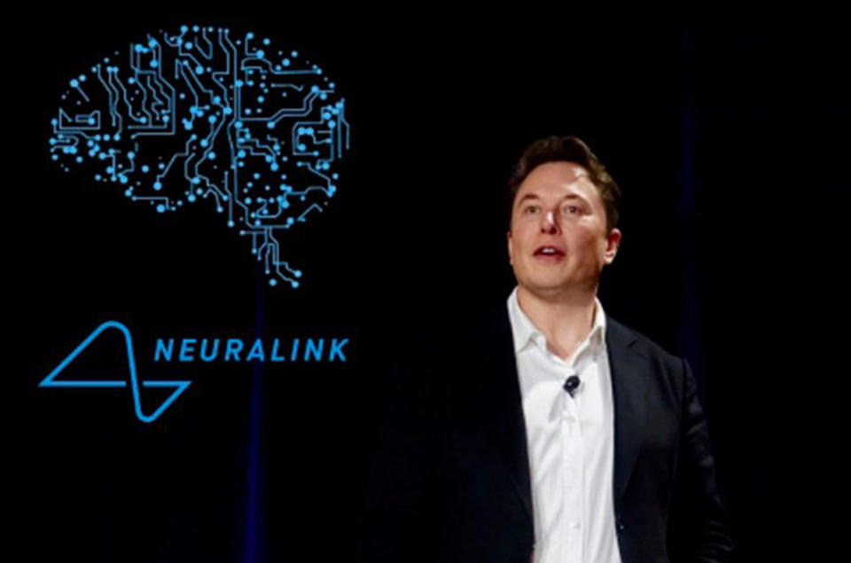 La musica trasmessa direttamente al cervello: l'ultima trovata di Elon Musk