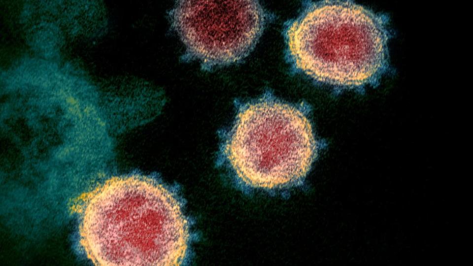 coronavirus