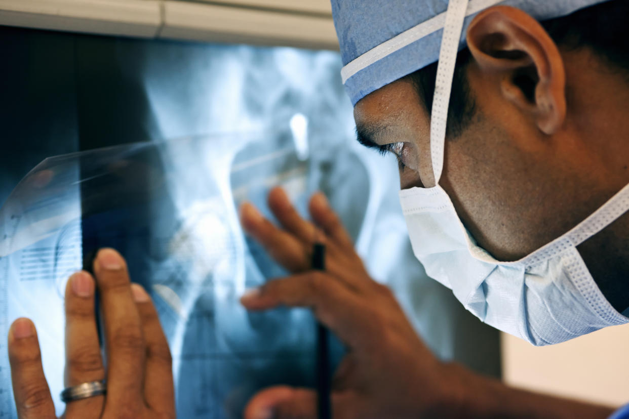 La radiologie permet d'identifier et d'analyser une large palette de blessures et de maladies... ou d'objets