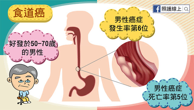 食道癌發生率