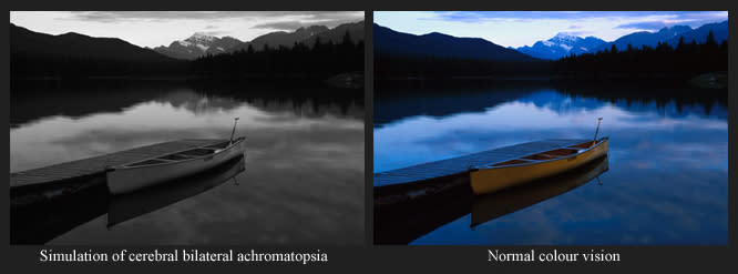 Comparación de un paisaje visto por una persona que tiene Acromatopsia versus una persona con visión normal (Foto: Wikimedia Commons)