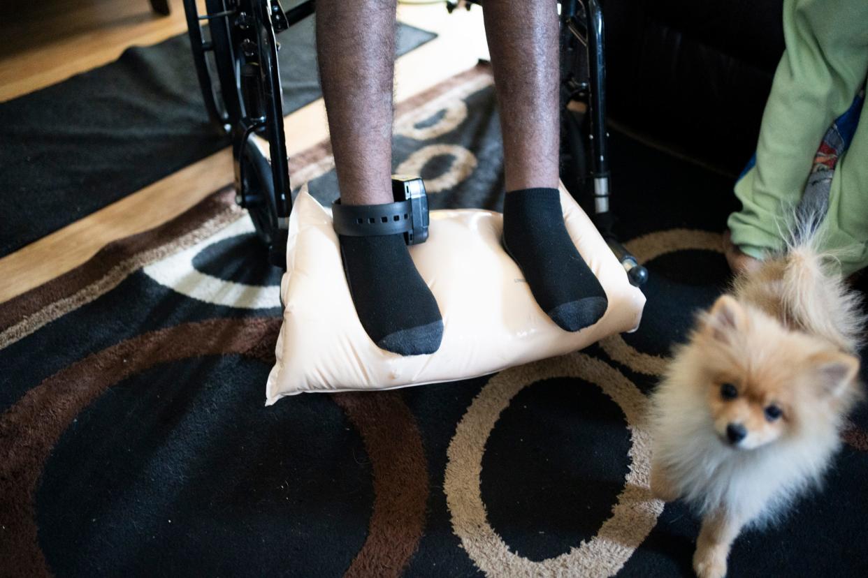 A court-ordered ankle monitor remains on Damarion Allen's leg. His mother has advocated for his judge to allow it to come off because it's rubbing his ankle raw.