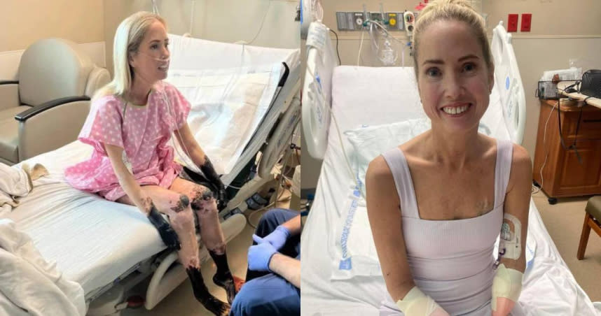 美國德州一名51歲高中女老師雪莉（Sherri Moody）肺部遭到感染，且出現感染性休克，為了保住她的性命，只能將四肢截肢。（圖／Twitter、Instagram／@joannaeasley73、@rechelleturner_）