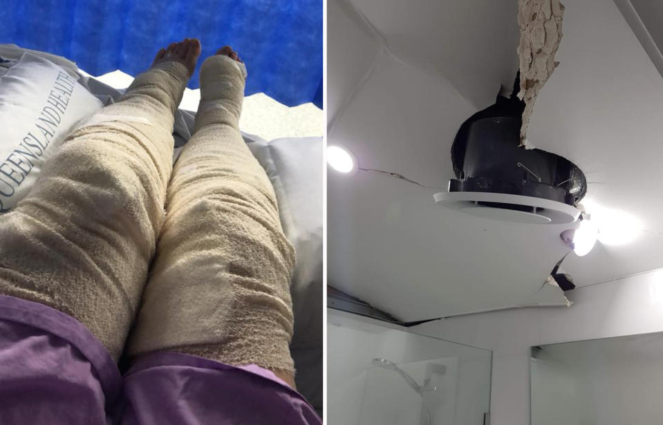 Ms Good is potentially facing a skin graft for her burnt legs. The blast blew the roof of her home’s roof (right). Source: Facebook/ Ayla Good