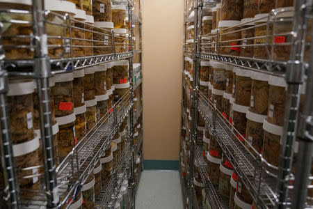 Human brains stored in formaldehyde are pictured at a brain bank in the Bronx borough of New York City, New York, U.S. June 28, 2017. REUTERS/Carlo Allegri