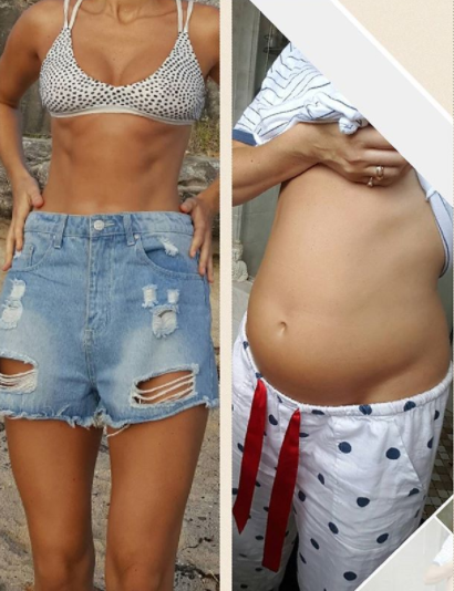 This is how her body changes when bloated because of IBS. Photo: Instagram/Alyce Crawford