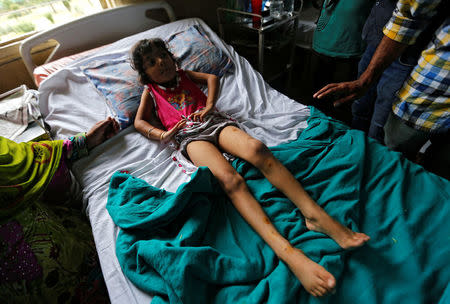 A girl who got injured in the clashes between police and protesters, reacts as she lies on a hospital bed, in Srinagar, July 14, 2016. REUTERS/Danish Ismail