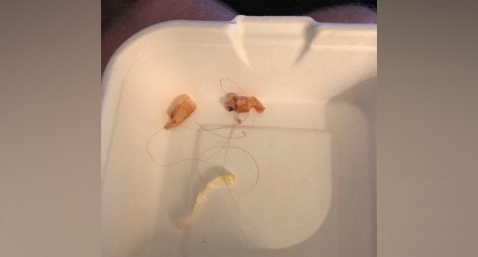 Norwich UK Deliveroo Byron burger customer found hair in his meal, but was refused a refund.