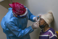 In this photograph taken Thursday May 21, 2020, Dr. Hugo Tempelman tests a member of the Ndlovu Youth Choir for Covid-19 at a clinic in the Moutse Valley, 160 kms (100 miles) north east of Johannesburg, South Africa. Finalists of the 2019 edition of the U.S. television show America's Got Talent, the coronavirus crisis put the choir's dreams on hold, as their tour got cancelled, and they returned to rural South Africa. (AP Photo/Jerome Delay)