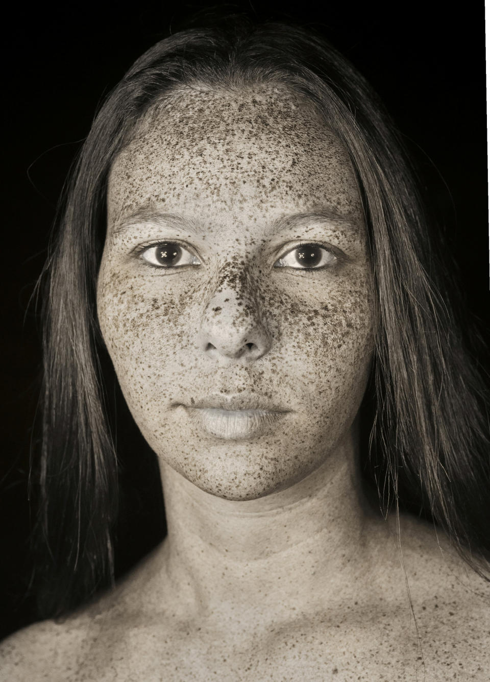 Photos show the ‘invisible’ damage the sun causes to skin